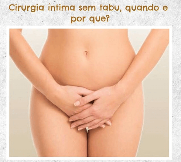 Ninfoplastia ou cirurgia íntima sem tabu Dra Danielle Gondim