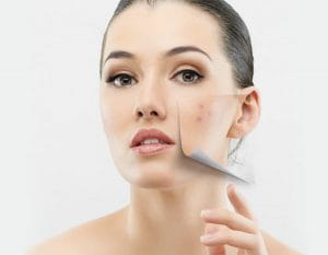 Cosmetologia de Cicatrizes