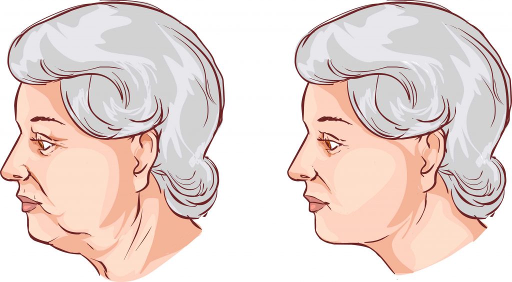Revitalização facial Dra. Danielle Gondim