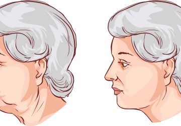 Revitalização facial com Lipoenxertia.